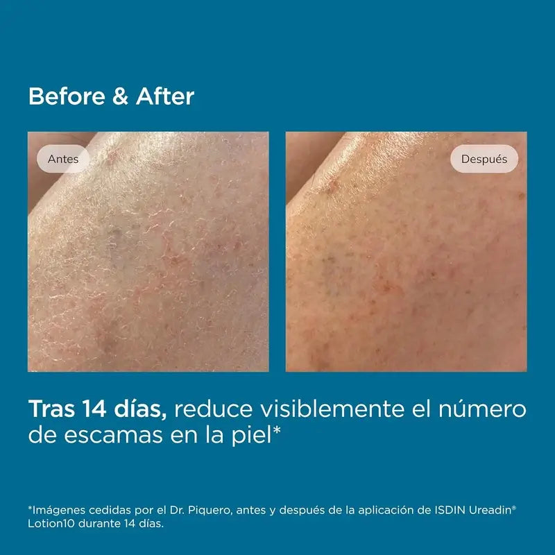 Isdin Ureadin Loción 1000 Ml