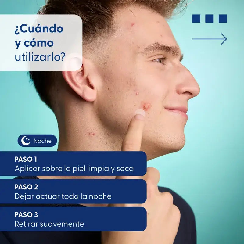 Urgo Spots Parches Hidrocoloides Micro Needling, 9 Unidades